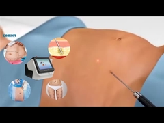 वजन घटाने के लिए लेजर लिपो उपकरण 30W 60W 980nm डायोड लिपो लेजर मशीन