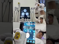 12d hifu +vmax +M8 +ICE HAMMER 4 IN 1